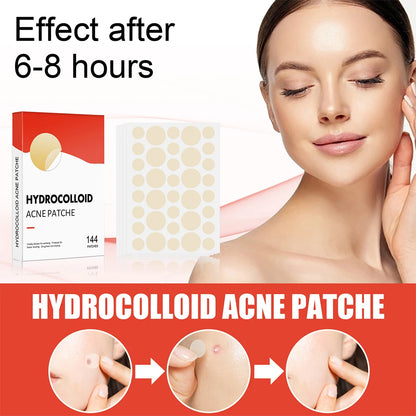 Hydrocolloid Acne Patch Invisible Closed Acne Patch Invisible Acne Face Invisible Waterproof Breathable Acne Skin Patch
