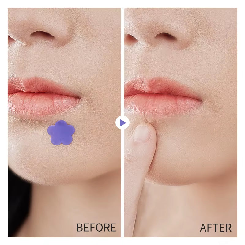 KORMESIC Colorful Star Acne Patches Pimple Nourishing Hydrating Anti-Aging Facial Treatment + Blackhead Removal Skin Care