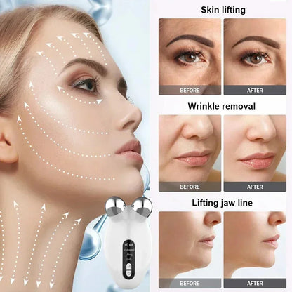 Facial Massager Microcurrent Roller EMS Device for Face Lifting Skin Tighten Rejuvenation Chin Remover anti Wrikle Double Care