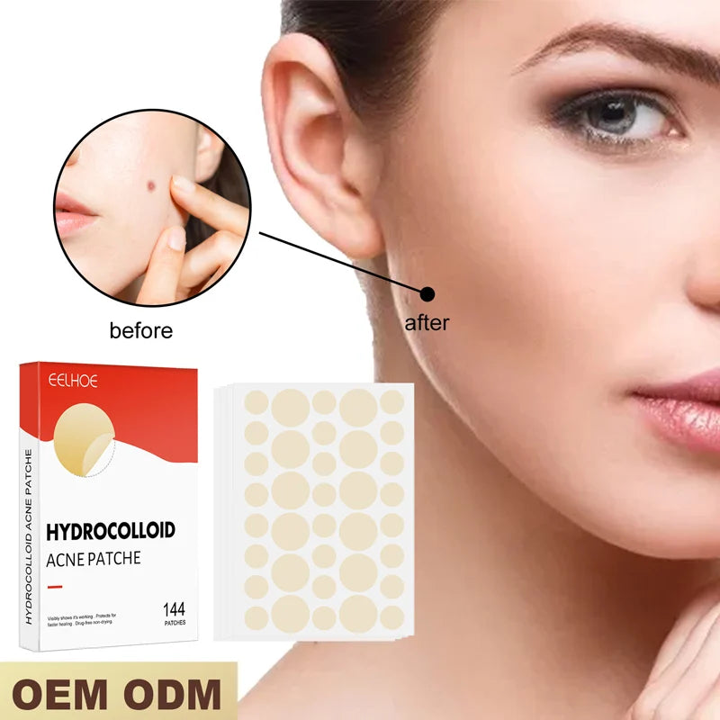 Hydrocolloid Acne Patch Invisible Closed Acne Patch Invisible Acne Face Invisible Waterproof Breathable Acne Skin Patch