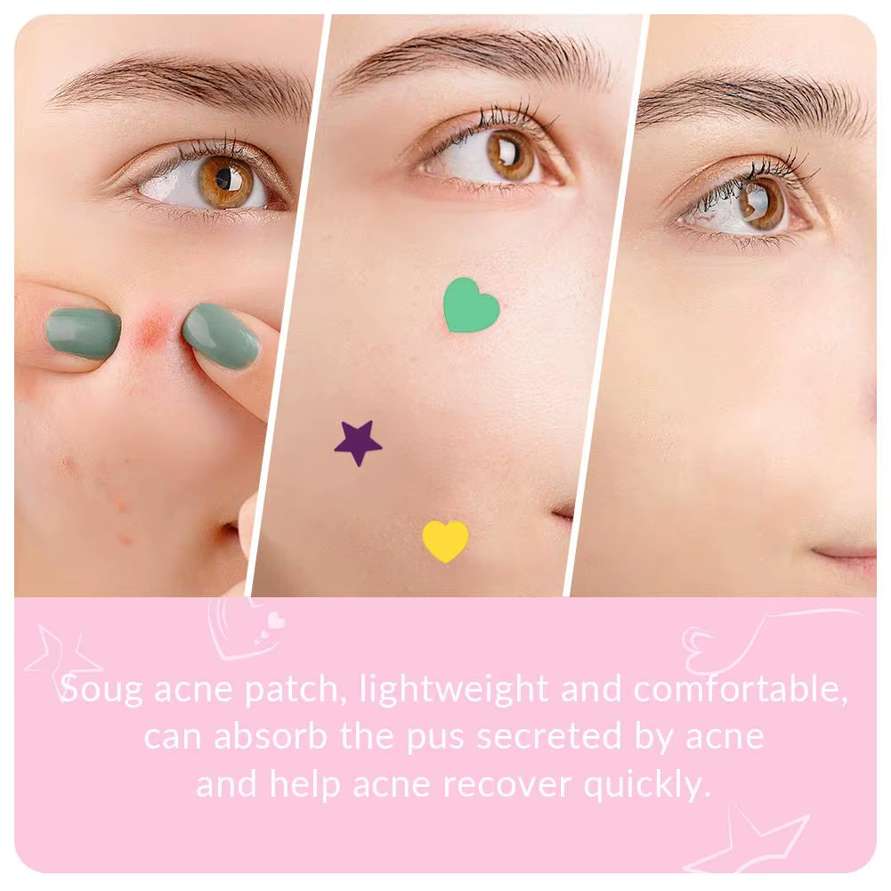 1/2Box Heart Shape Acne Pimple Patch Stickers Blemish Spot Concealer Cover 0.1Mm Acne Treatment Pimple Remover Skin Care
