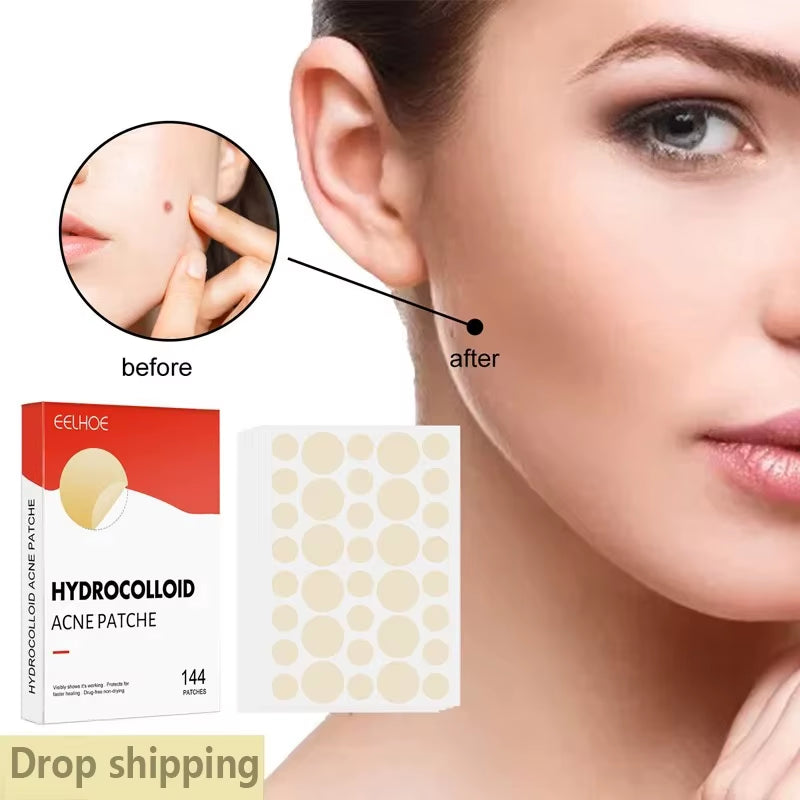 1/2/3 Box Face Acne Patch Invisible Skin Care Pimple Acne Patches Anti-Inflammatory Healing Absorbing Spot Sticker Covering Acne