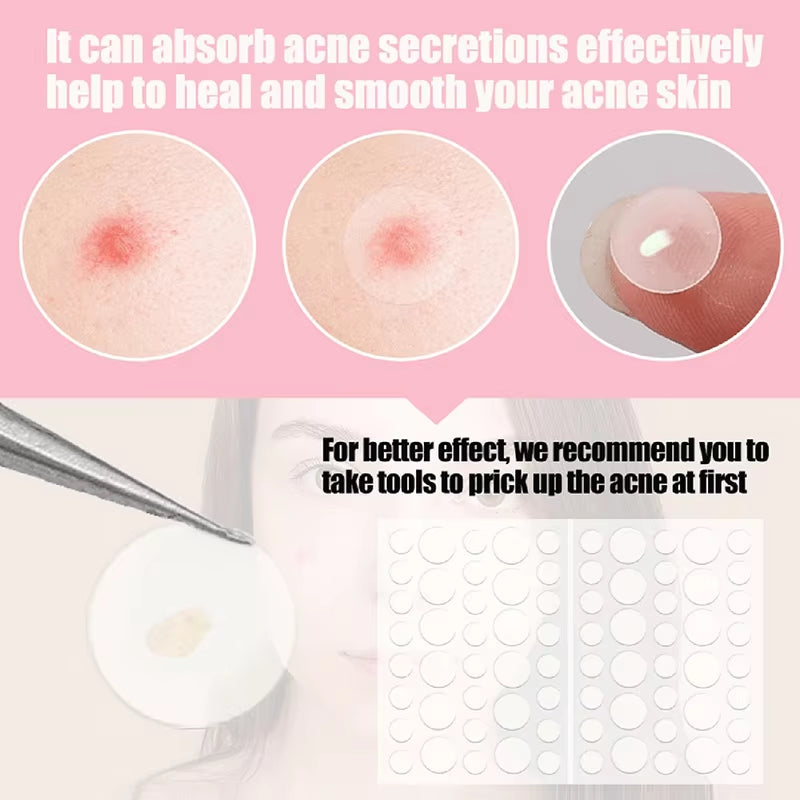 36Pcs Face and Body Pimple Patches for Covering Pimples, Acne Patches or Zit Spots Stickers, Body Patches