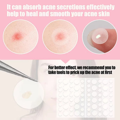 36Pcs Face and Body Pimple Patches for Covering Pimples, Acne Patches or Zit Spots Stickers, Body Patches