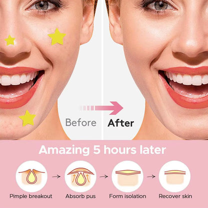 600 Counts Colorful Star Spot Acne/Pimple Patch for Face, Hydrocolloid Cute Star Shaped Acne Patch Invisible Zit Cover Stickers